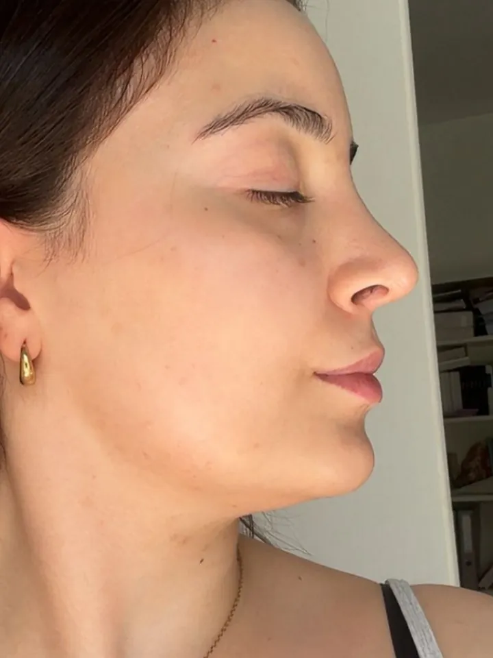 Teilnehmerin vorher, Halbprofil mit geschlossenen Augen