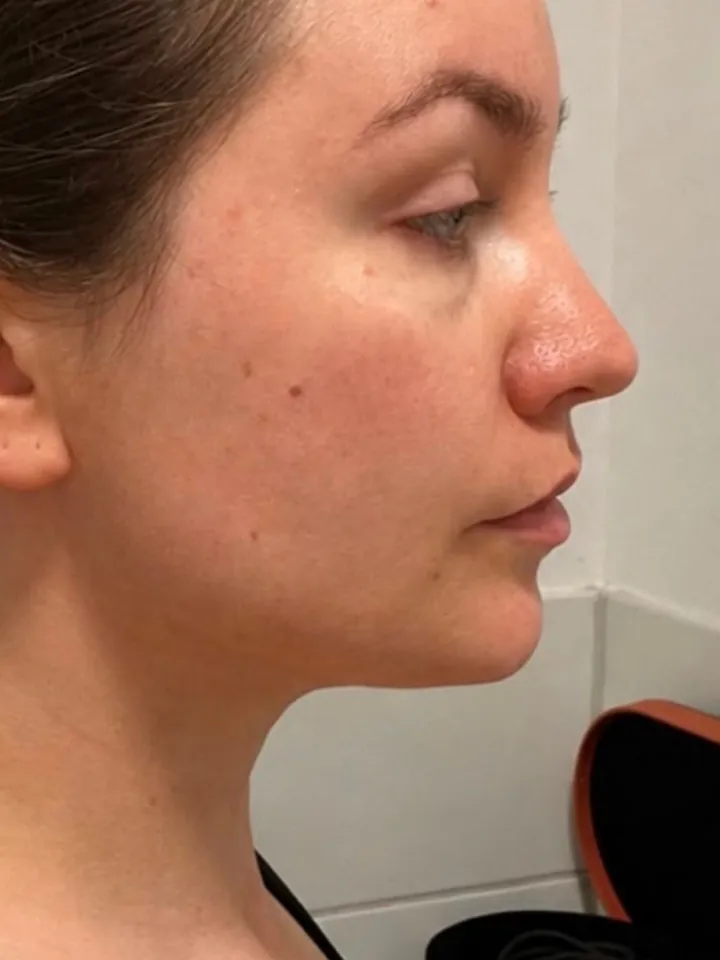 Dieselbe Teilnehmerin nachher im Profil