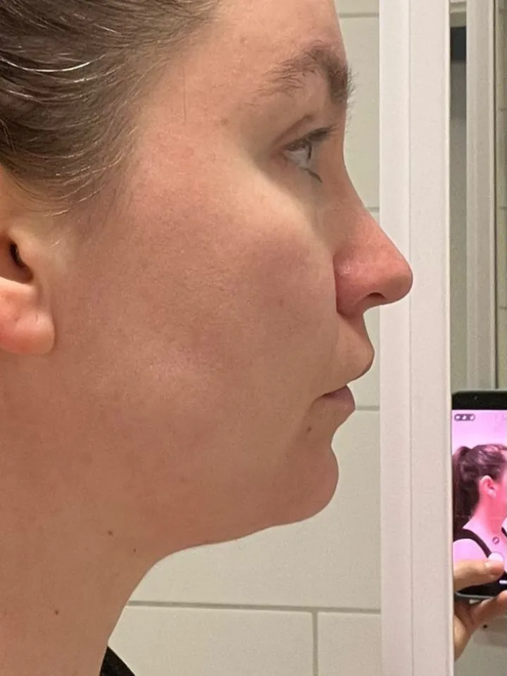 Teilnehmerin vorher im Profil, mit Zopf