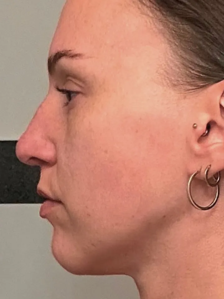 Teilnehmerin vorher im Profil, Blick nach links